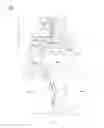 Fig. 02 - Cushioned check valve