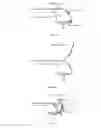 Fig. 25 - Devices for application and load bearing and method of using the same