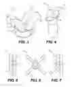 Fig. 04 - MODULAR AIR COOLED CONDENSER FLOW CONVERTER APPARATUS AND METHOD