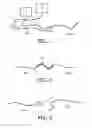 Fig. 02 - Optical shape sensing with a plurality of optical fibers