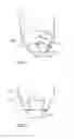 Fig. 03 - Reaction Vessel, Reaction Vessel Arrangement and Method for Analyzing a Substance