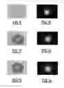 Fig. 04 - Method for observing organisms and associated system