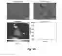 Fig. 09 - Selecting and isolating desirable t lymphocytes by change in mass responses