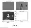 Fig. 10 - Selecting and isolating desirable t lymphocytes by change in mass responses