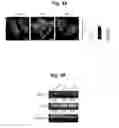 Fig. 06 - Construction of mitochondrial UQCRB mutant expressing cells and utilization of the cells for UQCRB assay system thereof