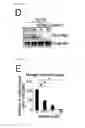 Fig. 19 - Method for determining prognosis of cancer