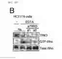 Fig. 22 - Method for determining prognosis of cancer