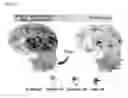 Fig. 03 - Diagnostic kit for diagnosis of abnormal protein aggregation- or misfolding-related diseases using dissociation of protein aggregates