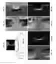 Fig. 10 - SENSOR DEVICE FOR DIRECT MAGNETIC FIELD IMAGING