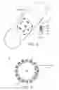 Fig. 03 - System for simultaneous PET/MR imaging