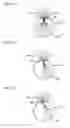 Fig. 06 - Image projection device and projection device