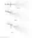 Fig. 06 - Ocular vision system with optical guide that can be positioned in two positions