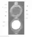 Fig. 01 - Viewing window assembly for single-sided installation