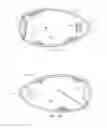 Fig. 05 - EYE PATCH ATTACHABLE TO EYEGLASSES