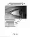 Fig. 26 - Eyewear pupilometer