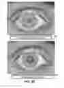 Fig. 32 - Eyewear pupilometer