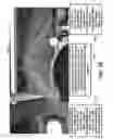 Fig. 35 - Eyewear pupilometer