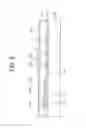 Fig. 05 - LIQUID CRYSTAL DISPLAY DEVICE