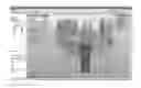 Fig. 01 - Tools for customized design of dental restorations