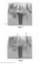 Fig. 03 - Tools for customized design of dental restorations