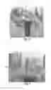 Fig. 04 - Tools for customized design of dental restorations