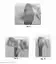 Fig. 05 - Tools for customized design of dental restorations