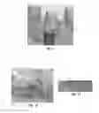 Fig. 06 - Tools for customized design of dental restorations