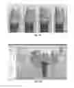 Fig. 07 - Tools for customized design of dental restorations