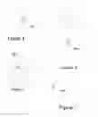 Fig. 05 - Temporary cutaneous information device and associated method and multi-patient treatment infrastructure