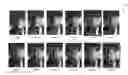 Fig. 01 - Continuous enrollment for face verification