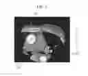Fig. 04 - Medical imaging apparatus, program installable in medical imaging apparatus, and medical imaging method