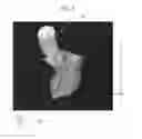 Fig. 05 - Medical imaging apparatus, program installable in medical imaging apparatus, and medical imaging method