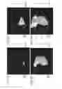 Fig. 06 - Medical imaging apparatus, program installable in medical imaging apparatus, and medical imaging method