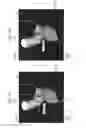 Fig. 08 - Medical imaging apparatus, program installable in medical imaging apparatus, and medical imaging method