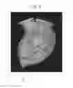 Fig. 10 - Medical imaging apparatus, program installable in medical imaging apparatus, and medical imaging method