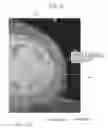 Fig. 13 - Medical imaging apparatus, program installable in medical imaging apparatus, and medical imaging method