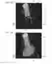 Fig. 16 - Medical imaging apparatus, program installable in medical imaging apparatus, and medical imaging method