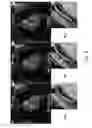 Fig. 08 - Method and system for “push-button” comprehensive cardiac MR examination using continuous self-gated 3D radial imaging