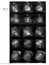 Fig. 10 - Method and system for “push-button” comprehensive cardiac MR examination using continuous self-gated 3D radial imaging
