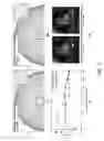 Fig. 13 - Method and system for “push-button” comprehensive cardiac MR examination using continuous self-gated 3D radial imaging