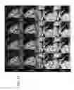 Fig. 14 - Method and system for “push-button” comprehensive cardiac MR examination using continuous self-gated 3D radial imaging