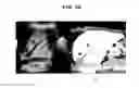 Fig. 11 - Method and apparatus for registration of medical images