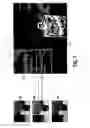 Fig. 07 - Image refocusing