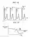 Fig. 18 - Image processing device, method, and medium for calculating propagation speed and direction of object pulsations