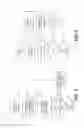 Fig. 07 - Methods and systems for powerline and radio frequency communications