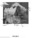 Fig. 07 - Pelvic model