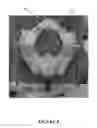 Fig. 09 - Pelvic model