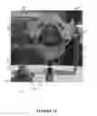 Fig. 17 - Pelvic model