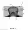 Fig. 34 - Pelvic model