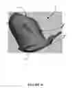 Fig. 35 - Pelvic model